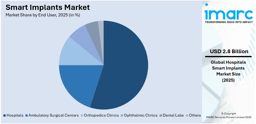 Smart Implants Market By End User