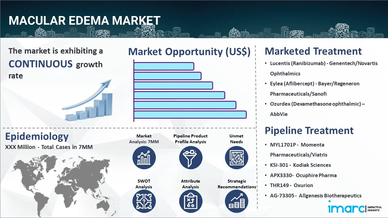 Macular Edema Market