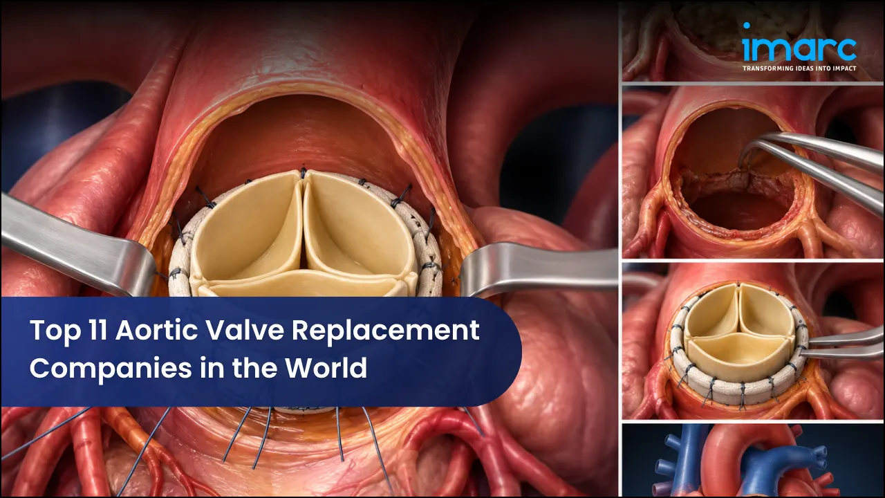 Top 11 Aortic Valve Replacement Companies in the World