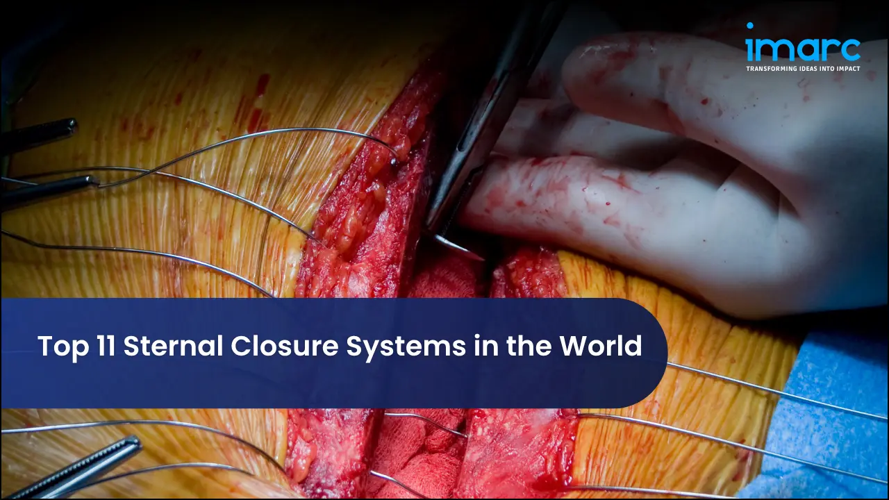 Top 11 Sternal Closure Systems in the World
